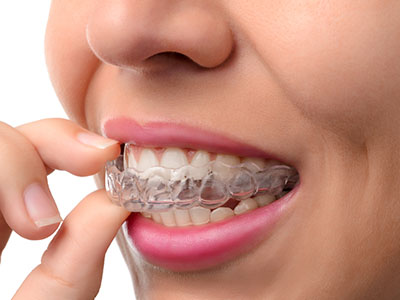 The image shows a person with clear braces, holding their finger near their mouth, possibly adjusting them.
