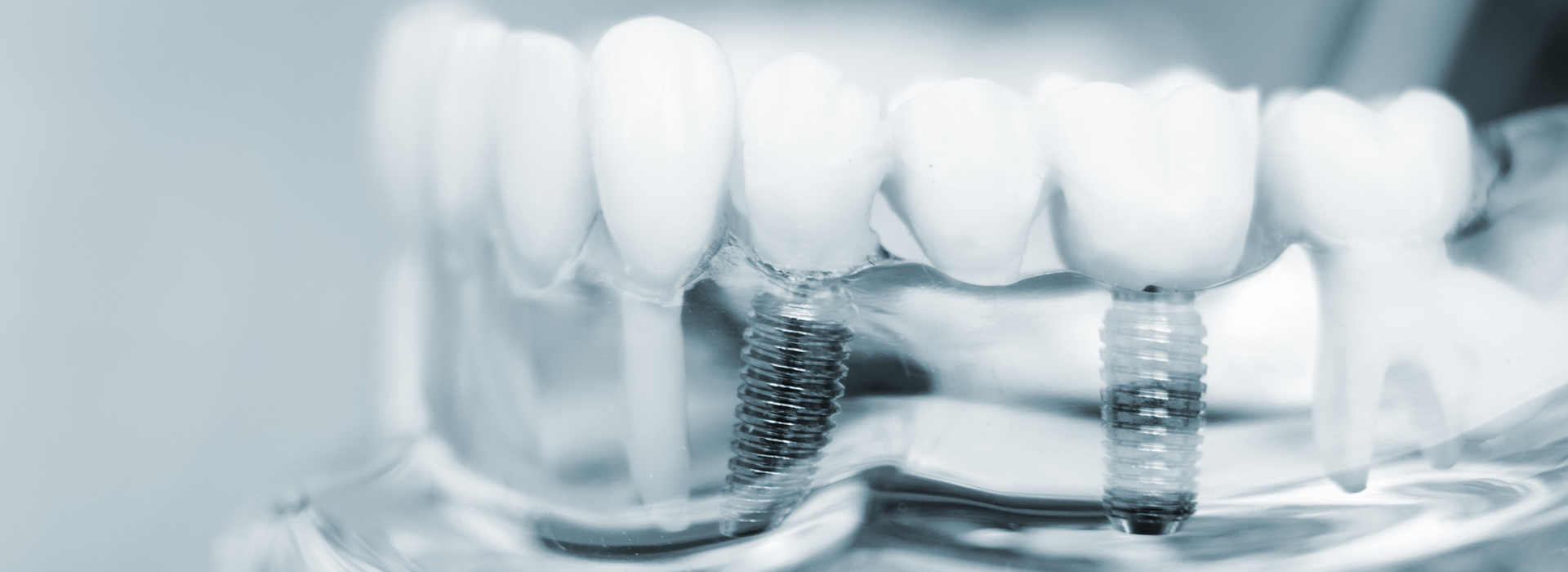 The image features a close-up of multiple toothbrushes with bristles, placed in an orderly manner next to each other, against a blurred background that suggests a dental setting.