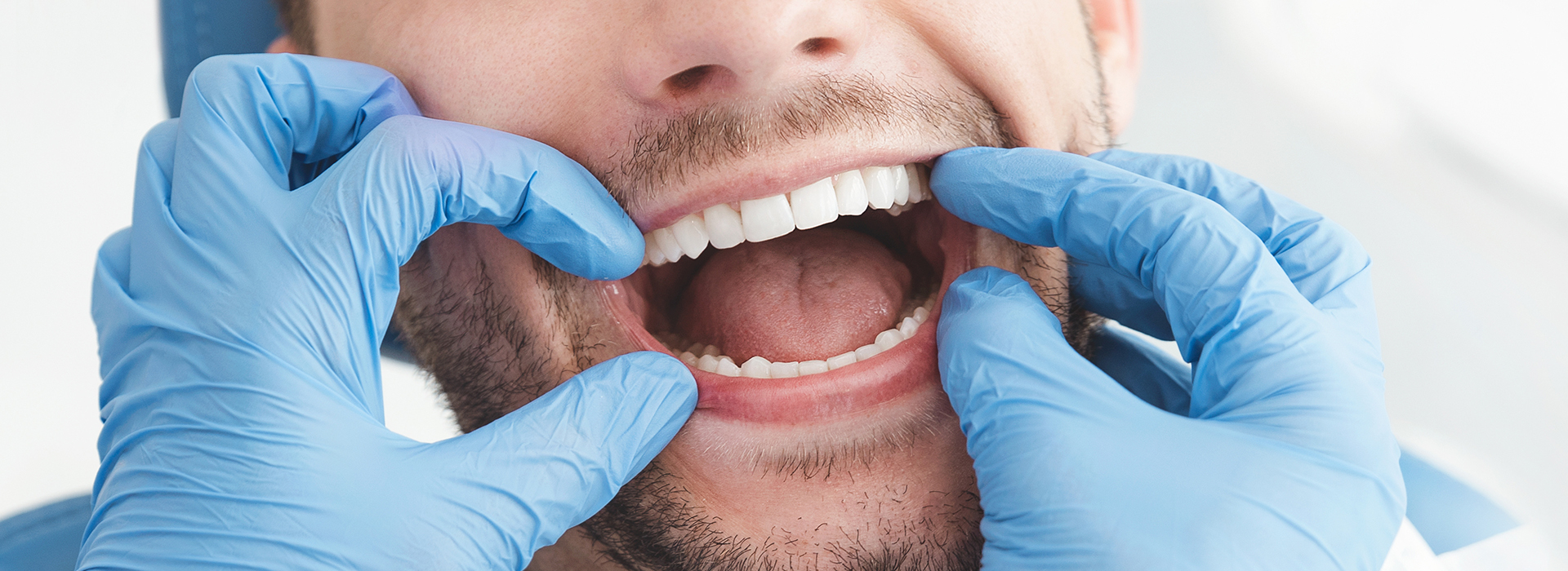 A dentist in blue gloves holding up a patient s open mouth with a dental mirror.