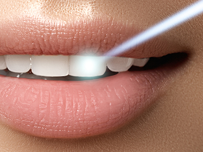The image shows a close-up view of a person s lips with a focus on their teeth, set against a blurred background that highlights the product being advertised, which appears to be a dental care device.
